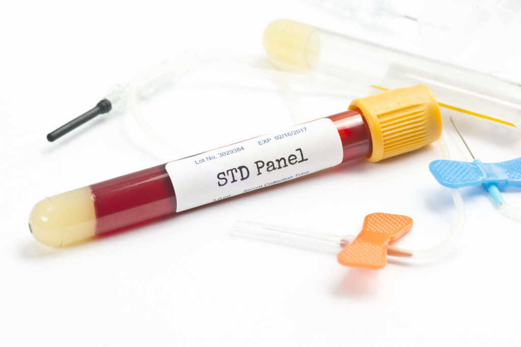 New gonorrhea strain may make STD untreatable