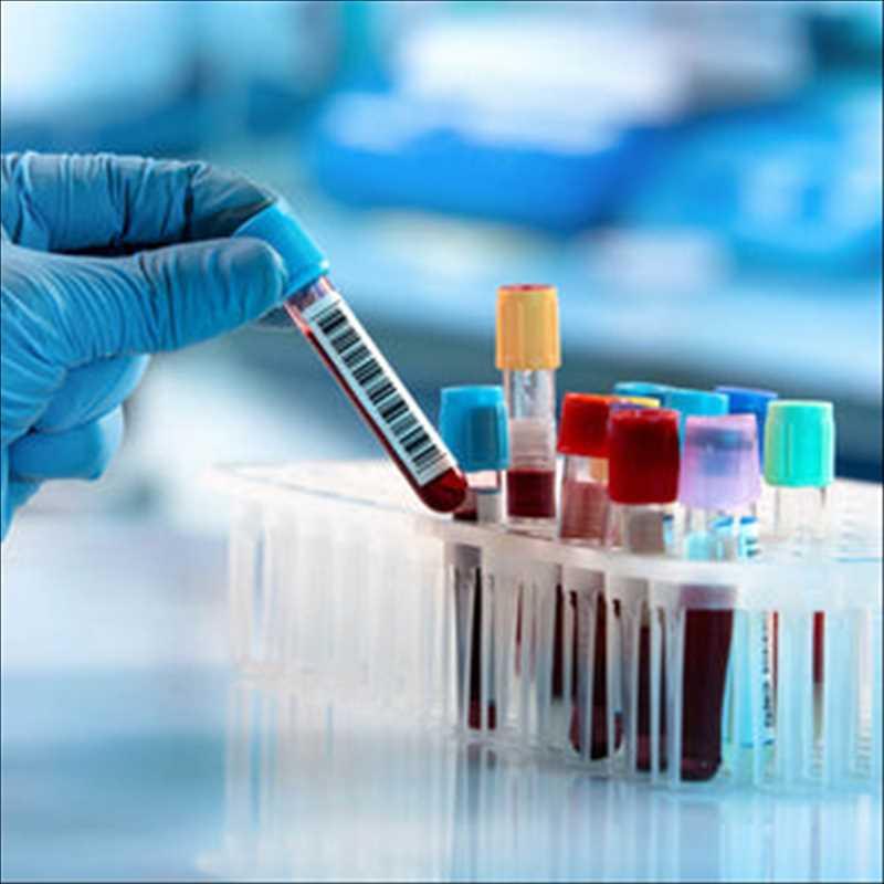 Global Sexually Transmitted Diseases (STD) Diagnost Market