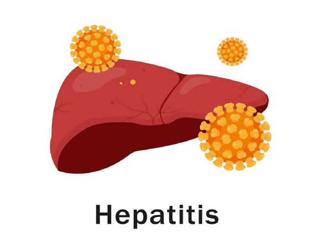 ancient_doctor: HEPATITIS; What you should know:

Hepatitis simply means i...