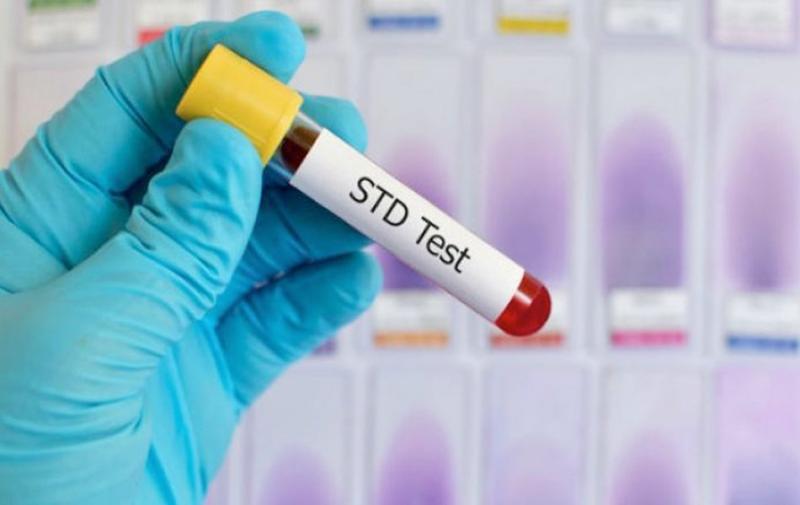 Sexually Transmitted Disease Testing Market