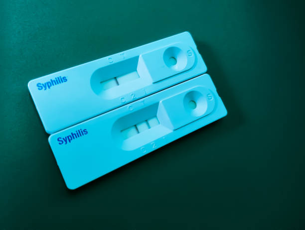 Syphilis Testing Market Analysis, Trend, Growth Rate, and Forecast 2023-202...
